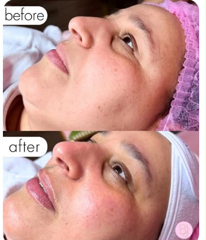 Signature facial